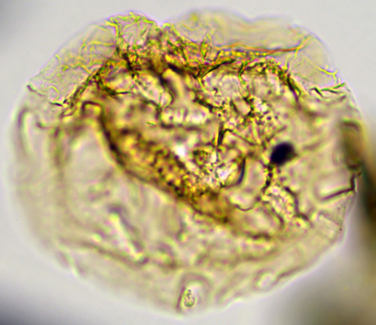 Heteraulacacysta pramparoae HprampX27390921351040Be holotype 63x.jpg